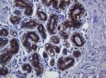 CDH1 Antibody in Immunohistochemistry (Paraffin) (IHC (P))