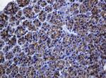 CDH1 Antibody in Immunohistochemistry (Paraffin) (IHC (P))