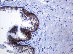 CDH1 Antibody in Immunohistochemistry (Paraffin) (IHC (P))