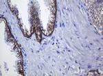 CDH1 Antibody in Immunohistochemistry (Paraffin) (IHC (P))