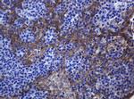 CDH1 Antibody in Immunohistochemistry (Paraffin) (IHC (P))