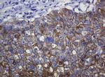 CDH1 Antibody in Immunohistochemistry (Paraffin) (IHC (P))