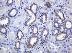 CDH1 Antibody in Immunohistochemistry (Paraffin) (IHC (P))