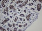 CDH1 Antibody in Immunohistochemistry (Paraffin) (IHC (P))