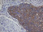 CDH1 Antibody in Immunohistochemistry (Paraffin) (IHC (P))