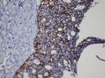 CDH1 Antibody in Immunohistochemistry (Paraffin) (IHC (P))