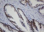 CDH1 Antibody in Immunohistochemistry (Paraffin) (IHC (P))