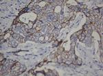 CDH1 Antibody in Immunohistochemistry (Paraffin) (IHC (P))