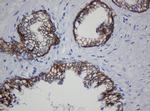CDH1 Antibody in Immunohistochemistry (Paraffin) (IHC (P))