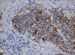 CDH1 Antibody in Immunohistochemistry (Paraffin) (IHC (P))