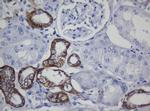 CDH1 Antibody in Immunohistochemistry (Paraffin) (IHC (P))