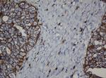 CDH1 Antibody in Immunohistochemistry (Paraffin) (IHC (P))