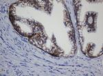 CDH1 Antibody in Immunohistochemistry (Paraffin) (IHC (P))