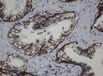 CDH1 Antibody in Immunohistochemistry (Paraffin) (IHC (P))