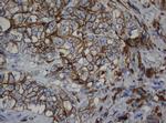 CDH1 Antibody in Immunohistochemistry (Paraffin) (IHC (P))