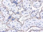 CDH1 Antibody in Immunohistochemistry (Paraffin) (IHC (P))
