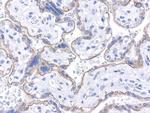 CDH1 Antibody in Immunohistochemistry (Paraffin) (IHC (P))