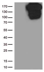 CDH1 Antibody in Western Blot (WB)