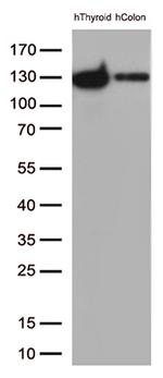 CDH1 Antibody in Western Blot (WB)