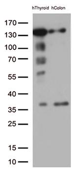 CDH1 Antibody in Western Blot (WB)