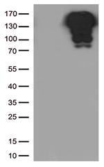 CDH1 Antibody in Western Blot (WB)