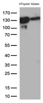 CDH1 Antibody in Western Blot (WB)