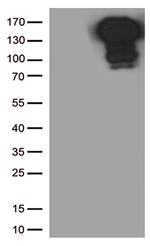 CDH1 Antibody in Western Blot (WB)