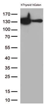 CDH1 Antibody in Western Blot (WB)