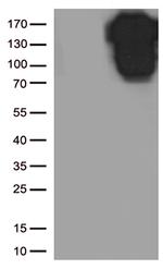 CDH1 Antibody in Western Blot (WB)