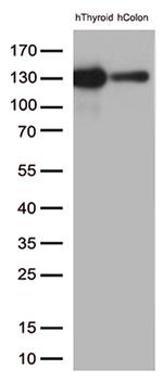 CDH1 Antibody in Western Blot (WB)