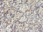 CDH2 Antibody in Immunohistochemistry (Paraffin) (IHC (P))