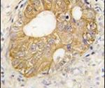 P-cadherin Antibody in Immunohistochemistry (IHC)