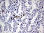 CDH4 Antibody in Immunohistochemistry (Paraffin) (IHC (P))