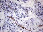 CDH5 Antibody in Immunohistochemistry (Paraffin) (IHC (P))
