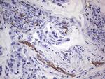 CDH5 Antibody in Immunohistochemistry (Paraffin) (IHC (P))