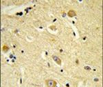CDIPT Antibody in Immunohistochemistry (IHC)