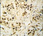 CDK1 Antibody in Immunohistochemistry (IHC)