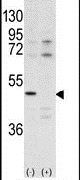 CDK10 Antibody in Western Blot (WB)