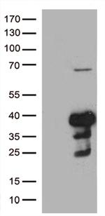 CDK15 Antibody in Western Blot (WB)