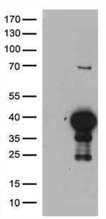 CDK15 Antibody in Western Blot (WB)
