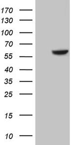 CDK17 Antibody in Western Blot (WB)