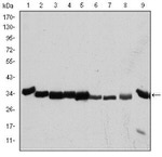 CDK1 Monoclonal Antibody (5A6)