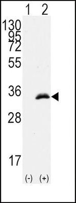 CDK1 Antibody in Western Blot (WB)