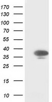 CDK2 Antibody in Western Blot (WB)