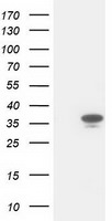 CDK2 Antibody in Western Blot (WB)