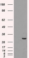 CDK5 Antibody in Western Blot (WB)