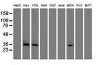 CDK5 Antibody in Western Blot (WB)