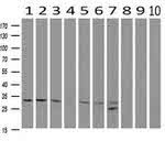 CDK5 Antibody in Western Blot (WB)