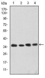 CDK5 Antibody in Western Blot (WB)