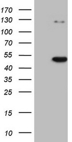 CDKL1 Antibody in Western Blot (WB)